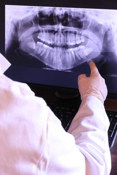 Best Urgent Care for Lost Fillings or Crowns in Montezuma, IA