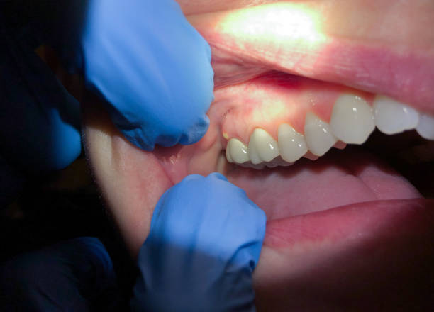Best Emergency TMJ Treatment in Montezuma, IA