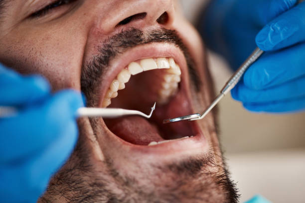 Best Emergency Treatment for Dental Infections or Abscesses in Montezuma, IA